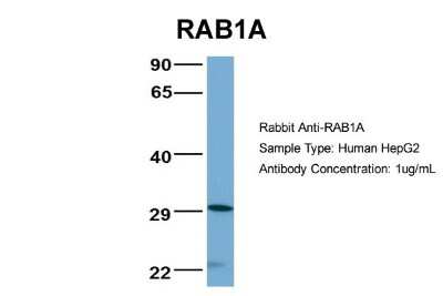 Western Blot: Rab1A Antibody [NBP1-55113]