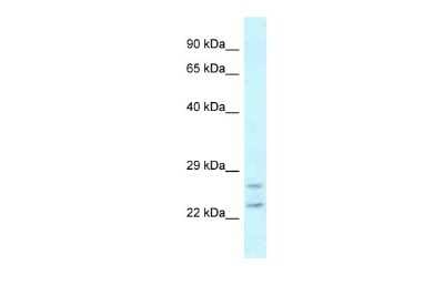 Western Blot: Rab2 Antibody [NBP2-82322]