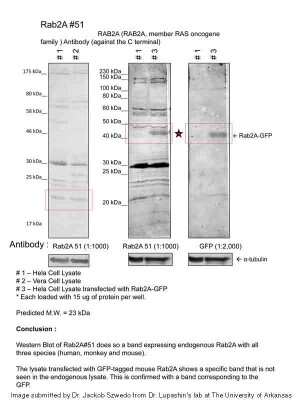 Western Blot: Rab2 Antibody [NBP2-82322]