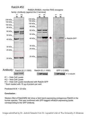 Western Blot: Rab2 Antibody [NBP2-82323]