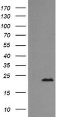 Western Blot: Rab24 Antibody (OTI3H1) [NBP2-45925]