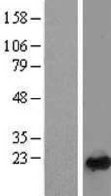 Western Blot: Rab24 Overexpression Lysate [NBL1-15052]