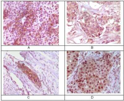 Immunohistochemistry: Rab25 Antibody (3F12F3) - BSA Free [NBP1-28845]