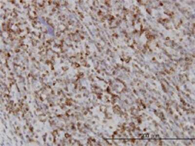 Immunohistochemistry-Paraffin: Rab27a Antibody (1G7) [H00005873-M02]