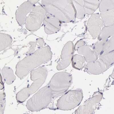 Immunohistochemistry-Paraffin: Rab27a Antibody [NBP1-83327]
