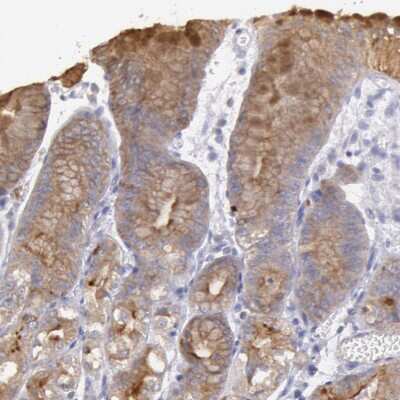 Immunohistochemistry-Paraffin: Rab27a Antibody [NBP1-83327]
