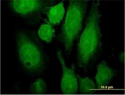 Immunocytochemistry/ Immunofluorescence: Rab3A Antibody (4H7) [H00005864-M01]
