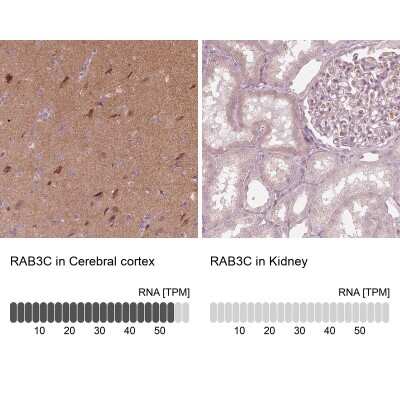 Immunohistochemistry-Paraffin: Rab3C Antibody [NBP2-55288]