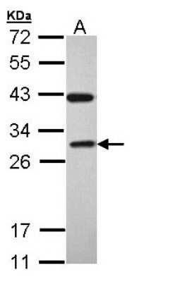 Western Blot: Rab3C Antibody [NBP1-32871]