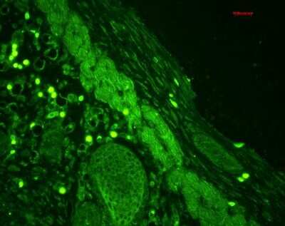 Immunohistochemistry: Rab4 Antibody [NBP3-18233]