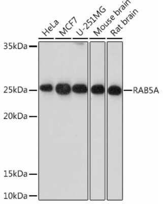 Western Blot: Rab5a Antibody (0K5J1) [NBP3-15442]
