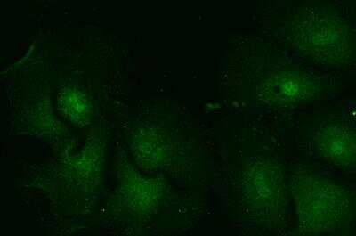 Immunocytochemistry/ Immunofluorescence: Rab5a Antibody [NB120-13253]
