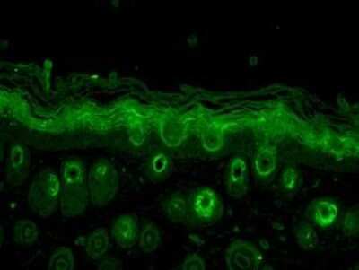 Immunohistochemistry: Rab5a Antibody [NB120-13253]