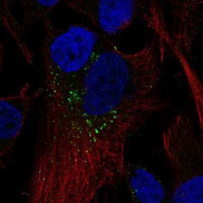 Immunocytochemistry/ Immunofluorescence: Rab5b Antibody [NBP2-57752]