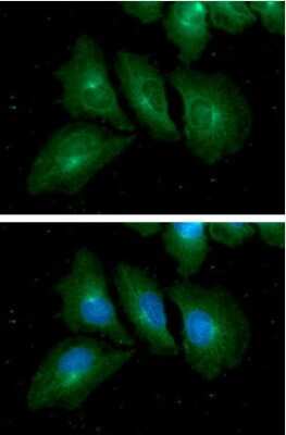 Immunocytochemistry/ Immunofluorescence: Rab7a Antibody (10E4) - BSA Free [NBP2-60237]