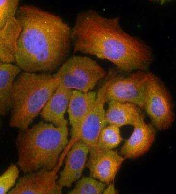 Immunocytochemistry/ Immunofluorescence: Rab7a Antibody - BSA Free [NBP2-24591]