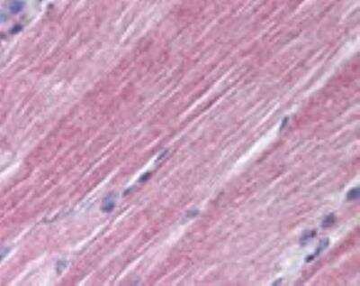 Immunohistochemistry-Paraffin: Rab7a Antibody - BSA Free [NBP2-24591]