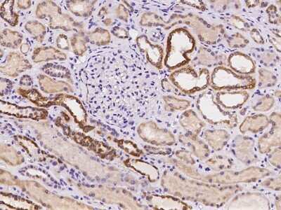 Immunohistochemistry-Paraffin: Rab7a Antibody [NBP2-97183]
