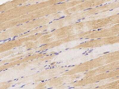 Immunohistochemistry-Paraffin: Rab7a Antibody [NBP2-98446]