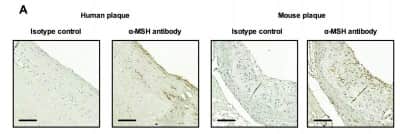 Immunohistochemistry: Rabbit IgG Isotype Control [NBP2-24891]