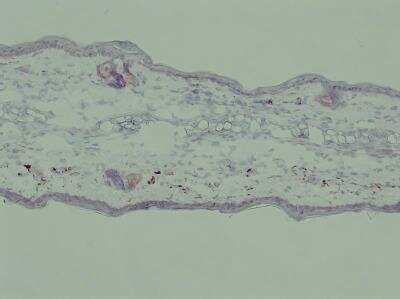Immunohistochemistry-Frozen: Rabbit IgG Isotype Control [NB810-56910]