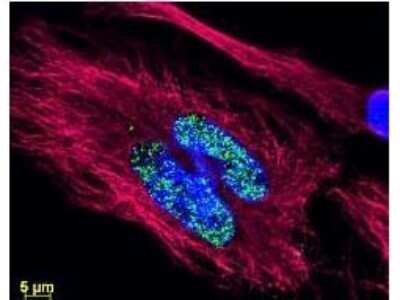 Immunocytochemistry/ Immunofluorescence: Rabbit anti-Mouse IgG2b Heavy Chain Secondary Antibody [NBP1-72795]