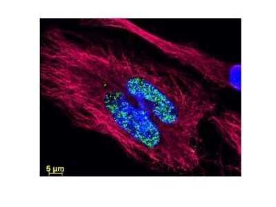 Immunocytochemistry/ Immunofluorescence: Rabbit anti-Sheep IgG (H+L) Secondary Antibody [NBP1-72704]