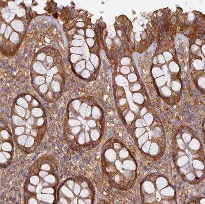 Immunohistochemistry-Paraffin: Rabenosyn 5 Antibody [NBP1-92310]