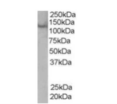 Western Blot: Rabenosyn 5 Antibody [NB300-813]