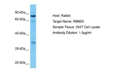 Western Blot: Rabenosyn 5 Antibody [NBP2-88119]