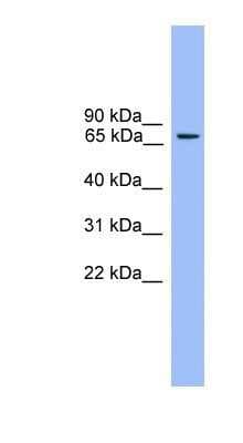 Western Blot: Rabphilin 3A Antibody [NBP1-69184]