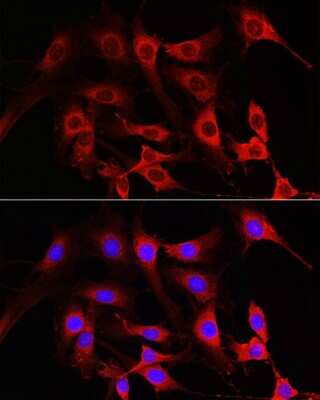 Immunocytochemistry/ Immunofluorescence: Rac1 Antibody - Azide and BSA Free [NBP2-94917]