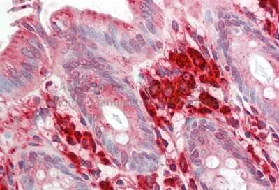 Immunohistochemistry-Paraffin: Rac1 Antibody [NBP2-82326]