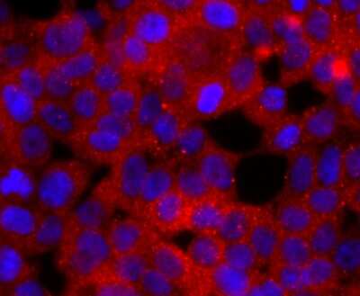 Immunocytochemistry/ Immunofluorescence: Rac1 Antibody (JM11-29) [NBP2-67091]