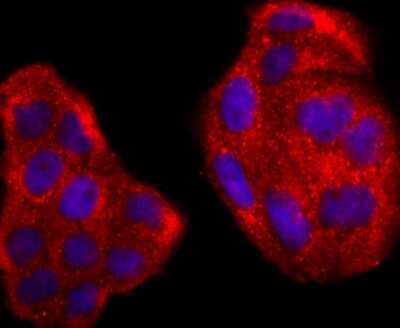 Immunocytochemistry/ Immunofluorescence: Rac1 Antibody (JM11-29) [NBP2-67091]