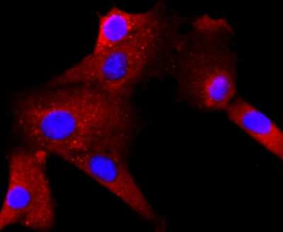 Immunocytochemistry/ Immunofluorescence: Rac1 Antibody (JM11-29) [NBP2-67091]