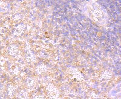 Immunohistochemistry-Paraffin: Rac1 Antibody (JM11-29) [NBP2-67091]