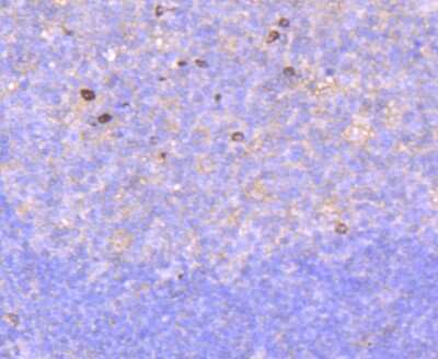 Immunohistochemistry-Paraffin: Rac1 Antibody (JM11-29) [NBP2-67091]