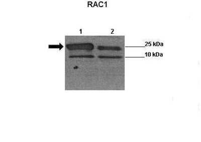 Western Blot: Rac1 Antibody [NBP2-82326]