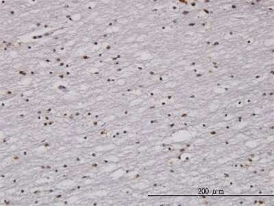 Immunohistochemistry-Paraffin: Rad1 Antibody (1G2) [H00005810-M01J]