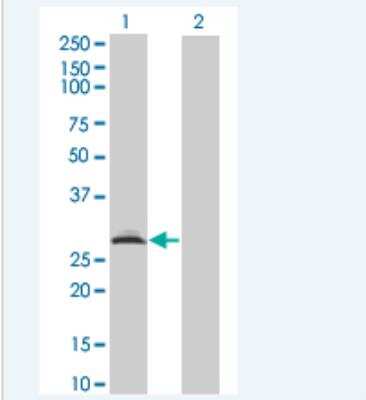 Western Blot: Rad1 Antibody (1G2) [H00005810-M01J]