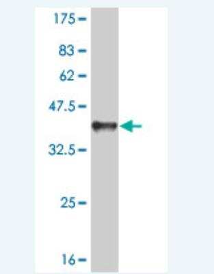 Western Blot: Rad1 Antibody (1G2) [H00005810-M01J]
