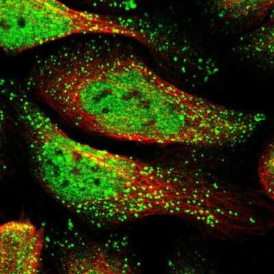 Immunocytochemistry/ Immunofluorescence: Rad1 Antibody [NBP2-13196]