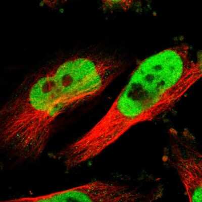 Immunocytochemistry/ Immunofluorescence: Rad21 Antibody [NBP1-83260]