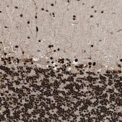 Immunohistochemistry-Paraffin: Rad21 Antibody [NBP1-83260]