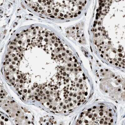 Immunohistochemistry-Paraffin: Rad21 Antibody [NBP1-83260]