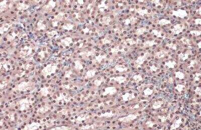 Immunohistochemistry-Paraffin: Rad21 Antibody [NBP2-20053]