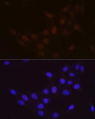 Immunocytochemistry/ Immunofluorescence: Rad23 Antibody (3B7T9) [NBP3-16573]