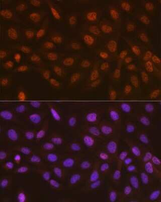 Immunocytochemistry/ Immunofluorescence: Rad23 Antibody (3B7T9) [NBP3-16573]