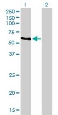 Western Blot: Rad23 Antibody (3C12) [H00005886-M01]